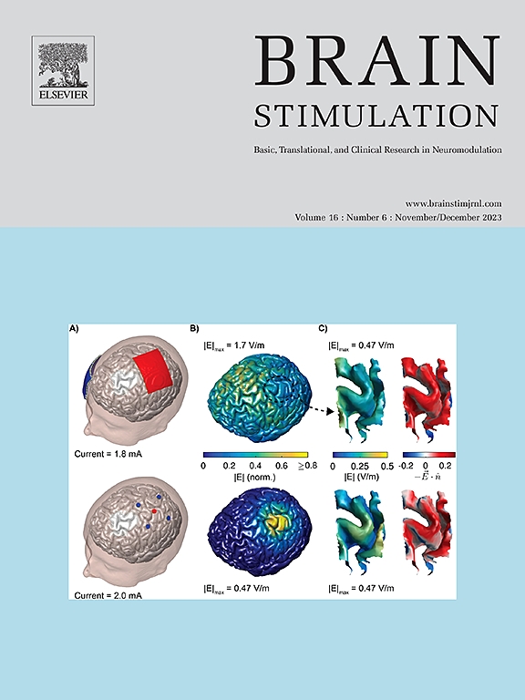 Go to journal home page - Brain Stimulation